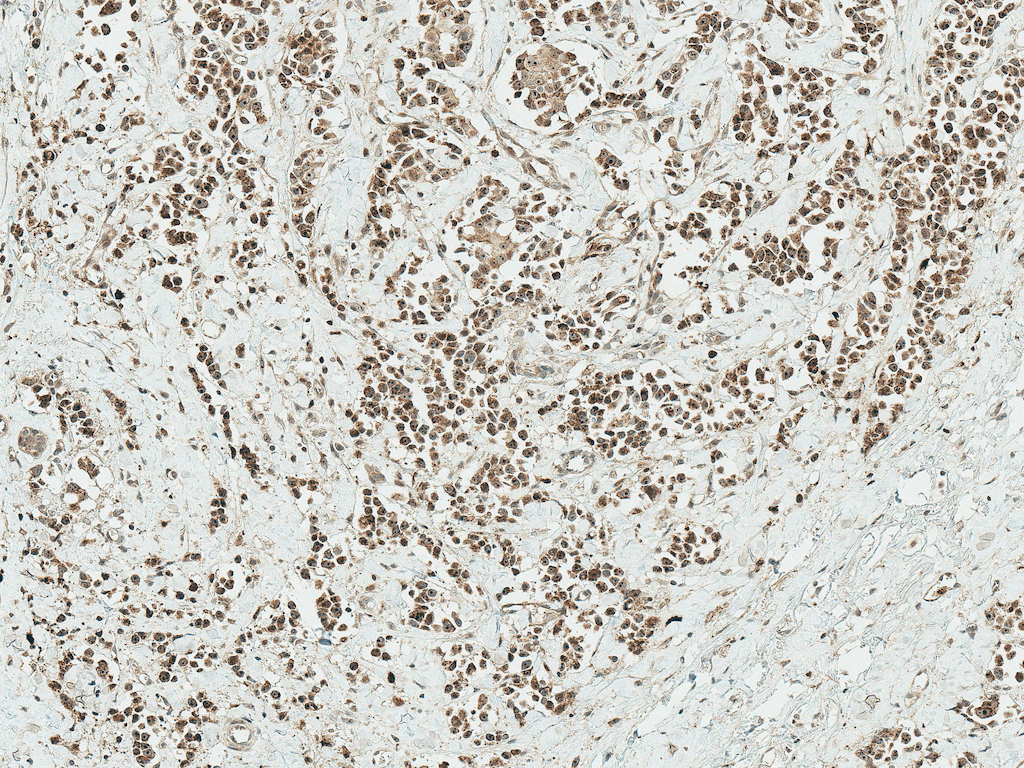 Polyclonal Rabbit anti-Human AKT1 Antibody (IHC, WB)