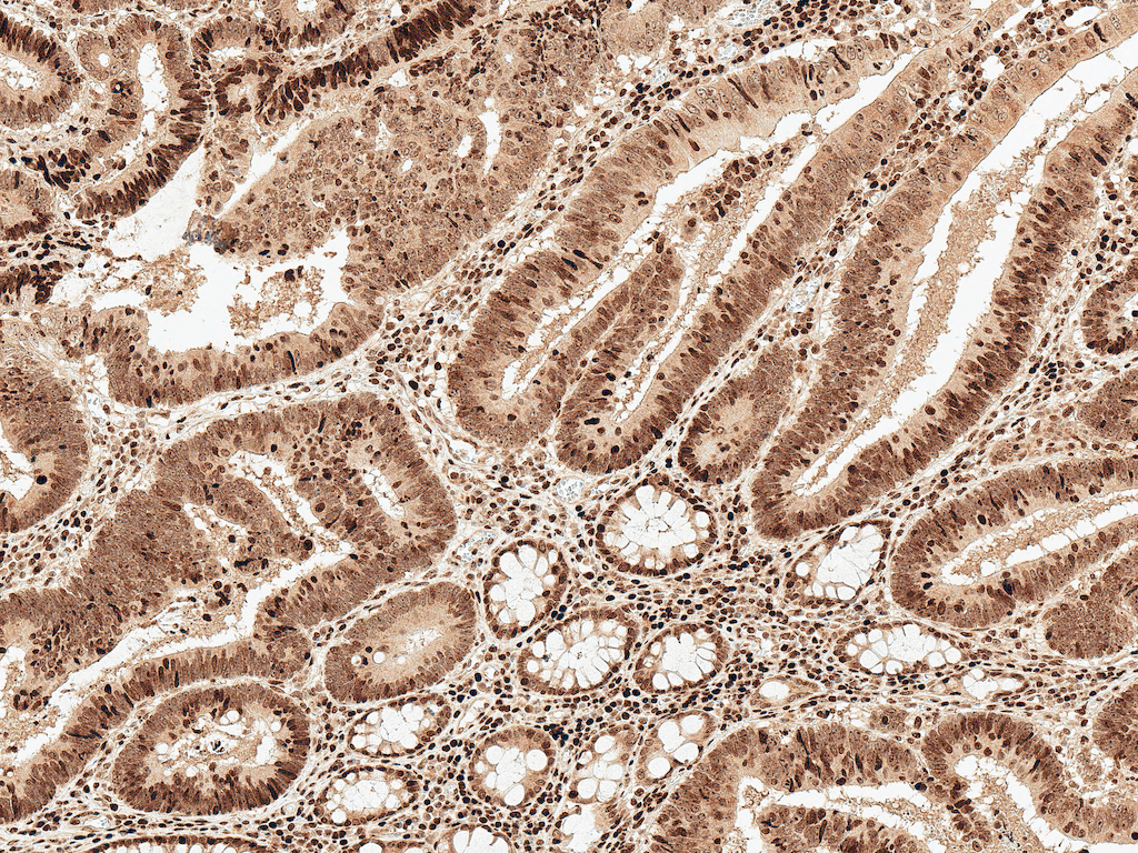 Polyclonal Rabbit anti-Human MCL1 / MCL 1 Antibody (RPE, IHC, WB)