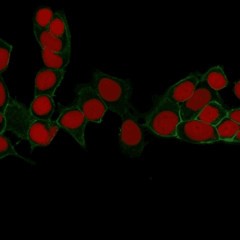 Monoclonal Mouse anti-Human EPCAM Antibody (clone EGP40/1372, IHC, IF, WB)