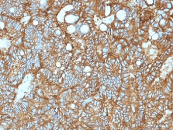 Monoclonal Mouse anti-Human EPCAM Antibody (clone EGP40/1372, IHC, IF, WB)