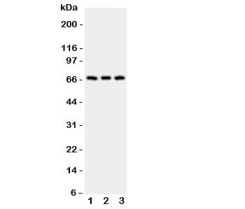 Polyclonal Rabbit anti-Human CD30 Antibody (WB)