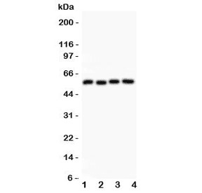Polyclonal Rabbit anti-Human CCNB1 / Cyclin B1 Antibody (WB)