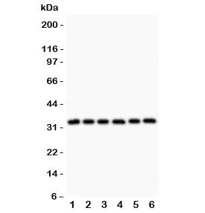 Polyclonal Rabbit anti-Human MYD88 Antibody (IHC, WB)