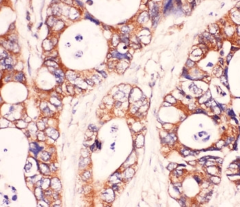 Polyclonal Rabbit anti-Human MYD88 Antibody (IHC, WB)