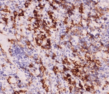 Polyclonal Rabbit anti-Human MYD88 Antibody (IHC, WB)