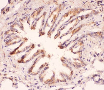 Polyclonal Rabbit anti-Human MYD88 Antibody (IHC, WB)