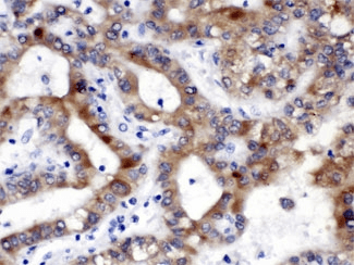 ALDH3A2 Antibody