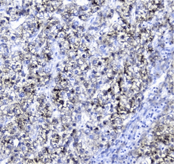 Polyclonal Rabbit anti-Human AMBP Antibody (IHC, WB)