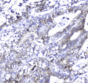 Polyclonal Rabbit anti-Human AMBP Antibody (IHC, WB)