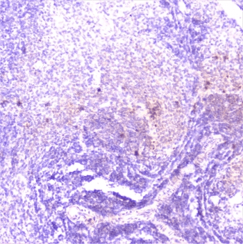 TANK Antibody