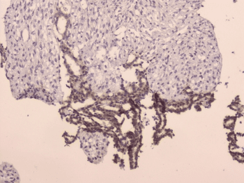 LRIG1 Antibody