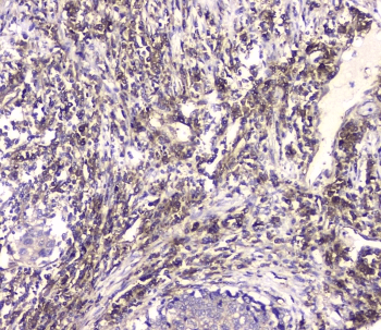 HECTD3 Antibody