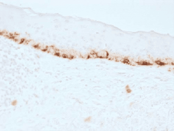 Monoclonal Mouse anti-Human MLANA / Melan-A Antibody (clone M2-7C10, IHC, IF)