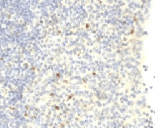 FOXP3 Antibody (clone FXP3/197)