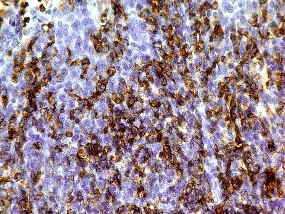 Monoclonal Mouse anti-Human CD3E Antibody (IHC, WB)