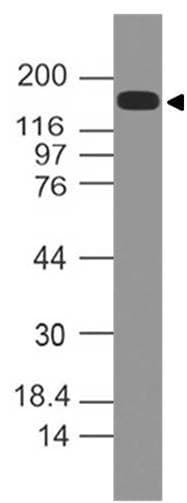 Polyclonal Rabbit anti-Human EIF3A Antibody (WB)