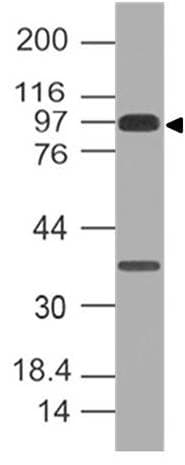 CDH1 / E Cadherin Antibody