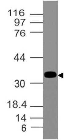 Polyclonal Rabbit anti-Human EPCAM Antibody (WB)