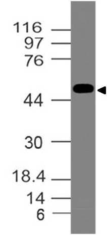 Polyclonal Rabbit anti-Human ER Alpha / Estrogen Receptor Antibody (WB)