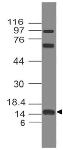 Polyclonal Rabbit anti-Human E-FABP / FABP5 Antibody (WB)