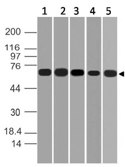 Polyclonal Rabbit anti-Human CNOT4 / CLONE243 Antibody (WB)