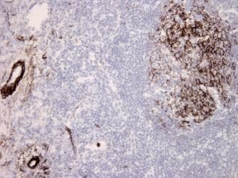 Complement C9 Antibody (clone aE11)