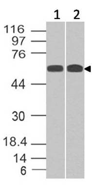 Polyclonal Rabbit anti-Human SMAD4 Antibody (WB)