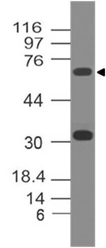 Monoclonal Mouse anti-Human TP73 / p73 Antibody (WB)