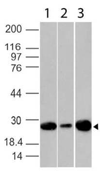 BCL2 / Bcl-2 Antibody (aa41-54, clone ABM3C35)