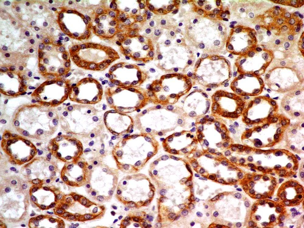 BCL2 / Bcl-2 Antibody (aa41-54, clone ABM3C35)