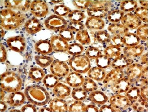 Monoclonal Mouse anti-Human TLR7 / CD287 Antibody (Azide-free, IHC)