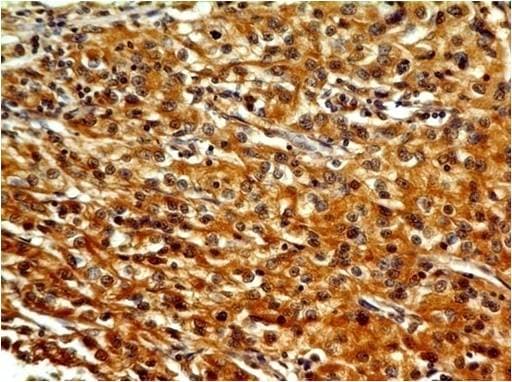 Monoclonal Mouse anti-Human TLR7 / CD287 Antibody (Azide-free, IHC)