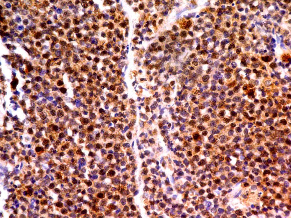 Monoclonal Mouse anti-Human MLH1 Antibody (IHC)