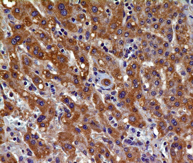 Monoclonal Mouse anti-Human KDR / VEGFR2 / FLK1 Antibody (IHC)