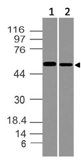 Polyclonal Rabbit anti-Human SOX9 Antibody (WB)