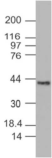 Monoclonal Mouse anti-Human PINK1 Antibody (WB)