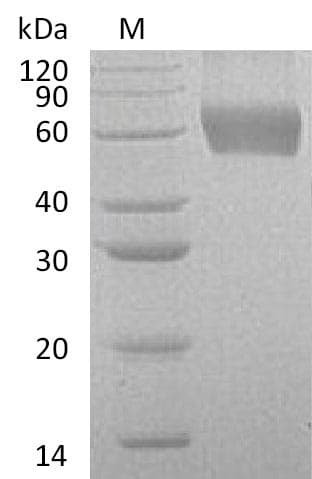 Human CSF2RA / CD116 Protein (Recombinant 6His, C-terminus)