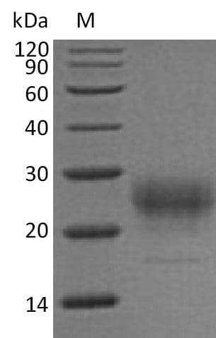 Mouse IL7 Protein (Recombinant 6His, C-terminus)