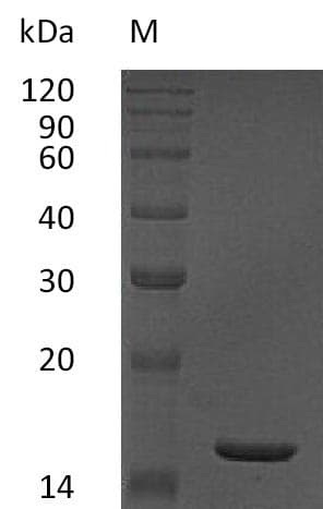 Human TNF Alpha Protein (Recombinant)