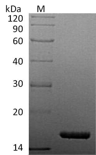 Human TNF Alpha Protein (Recombinant 6His, C-terminus)