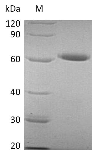 Human NT5E / eNT / CD73 Protein (Recombinant 6His, C-terminus)