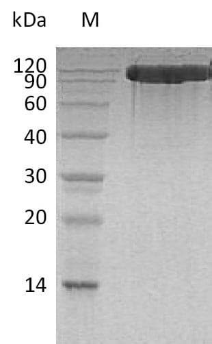 Human ACE2 / ACE-2 Protein (Recombinant 6His, C-terminus)