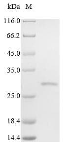 Human FBP / FOLR2 Protein (Recombinant 10His, N-terminus)