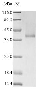 Human RHD Protein (Recombinant 10His, C-terminus)