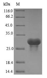 Human Complement C1QA Protein (Recombinant 10His, N-terminus + Myc, C-terminus)