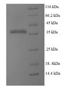 Human DHFR Protein (Recombinant 6His-SUMO, N-terminus)