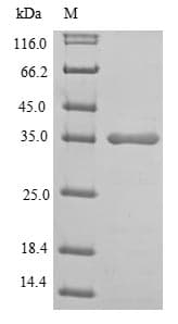 Human LDHA / LDH1 Protein (Recombinant)