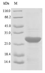 Human TRA2B / SFRS10 Protein (Recombinant 6His-SUMO, N-terminus)