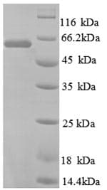 Human TROVE2 Protein (Recombinant 6His, N-terminus)
