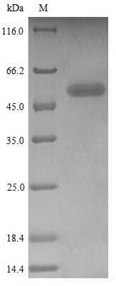 Human CD244 Protein (Recombinant GST, N-terminus)